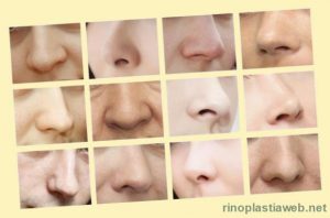 Tipos de nariz