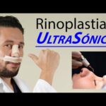 Rinoplastia Ultrasonica Cerrada: La Mejor Opción Para Tu Nariz